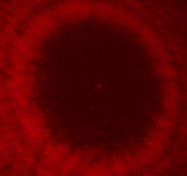 Circular Obstacle Diffraction: Poisson's Spot